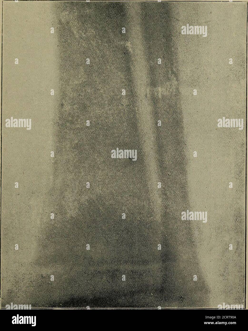 Pan Röntgen . The Röntgen rays in medical work . be stated thatthe first picture ...