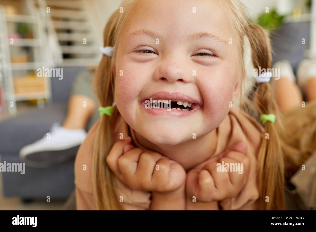 Close up portrait of blonde girl with down syndrome smiling happily looking at camera while lying on sofa at home Stock Photo