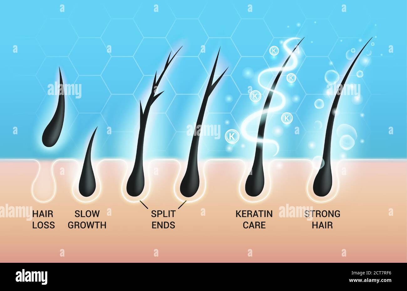 Different hair problems and deep salon treatment vector illustrations set, macro view of balding scalp skin and follicles Stock Vector