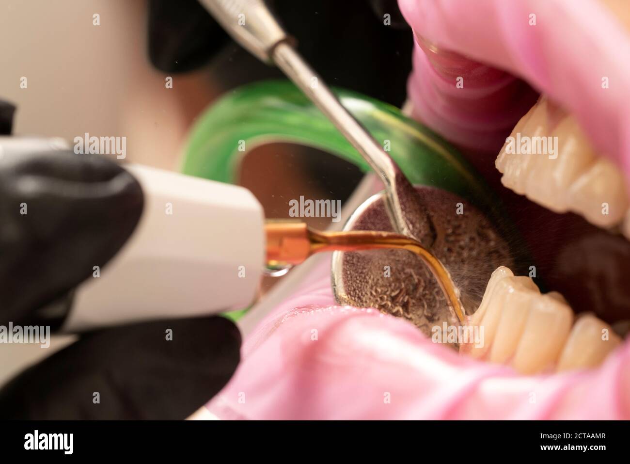 Closeup of dental calculus plaque remover tool Stock Photo Alamy