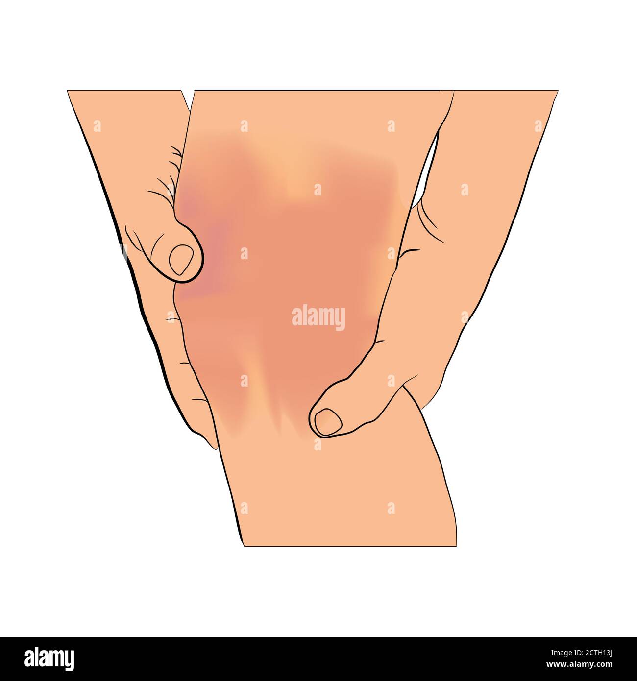Tendon knee joint problems on leg from exercise vector illustration Stock Vector
