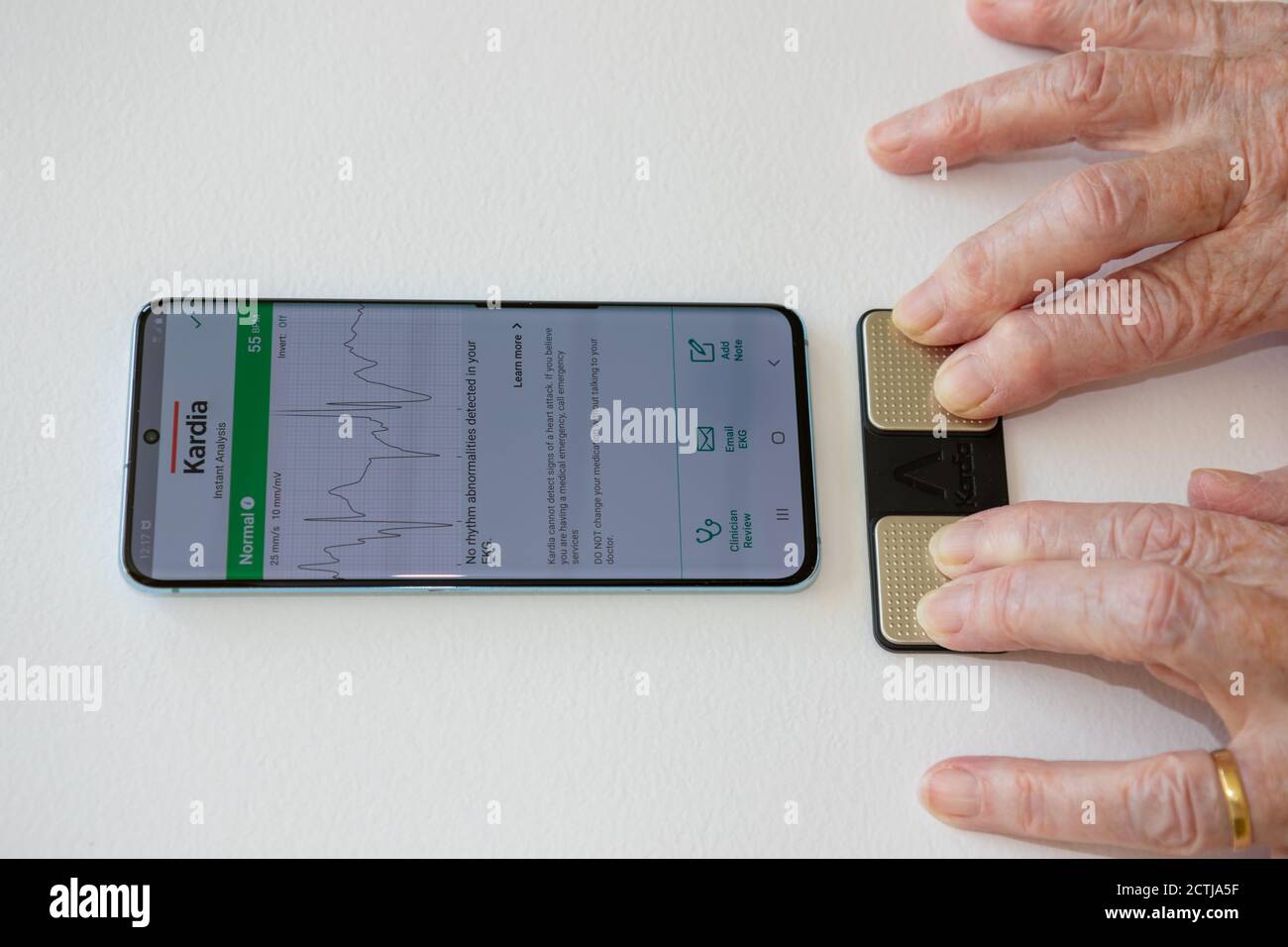 Ekg ecg electrocardiogram graph displayed on smartphone using Kardia