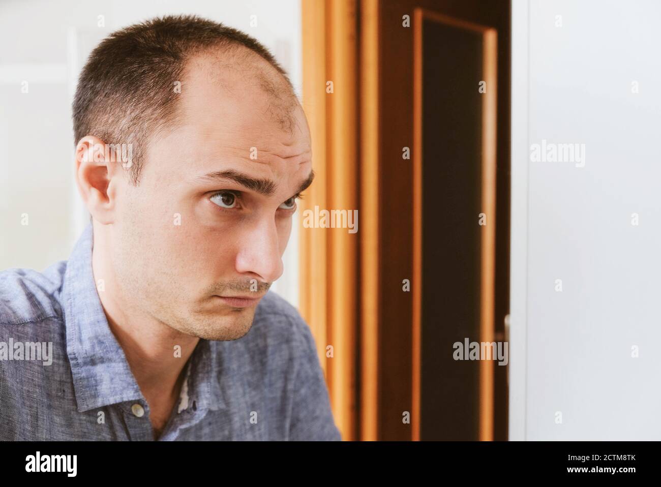 Balding young deals