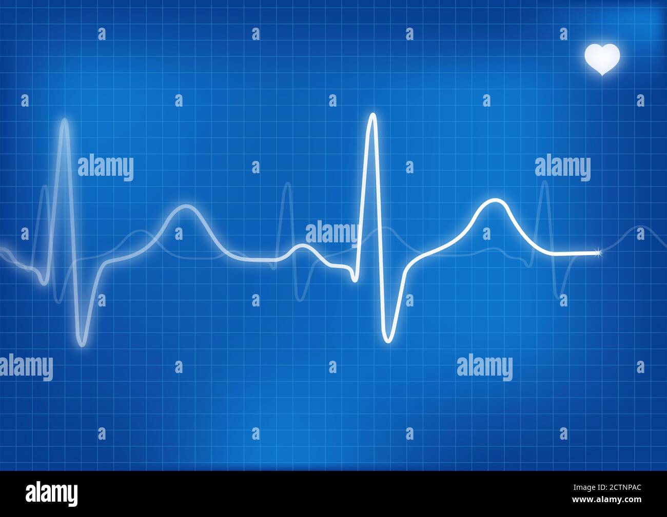 Human electrocardiogram hi-res stock photography and images - Alamy