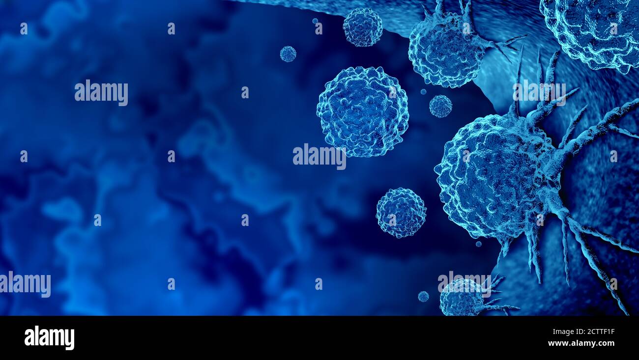 Cancer outbreak and treatment for malignant cancer cells in a human body caused by carcinogens and genetics with cancerous cell as an immunotherapy. Stock Photo