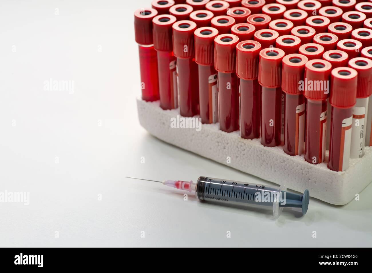 Injection syringe with vials of blood samples of patients at a medical