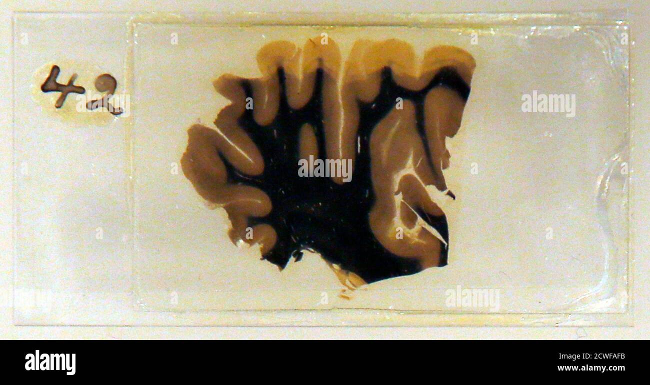 Einsteins Brain High Resolution Stock Photography And Images Alamy