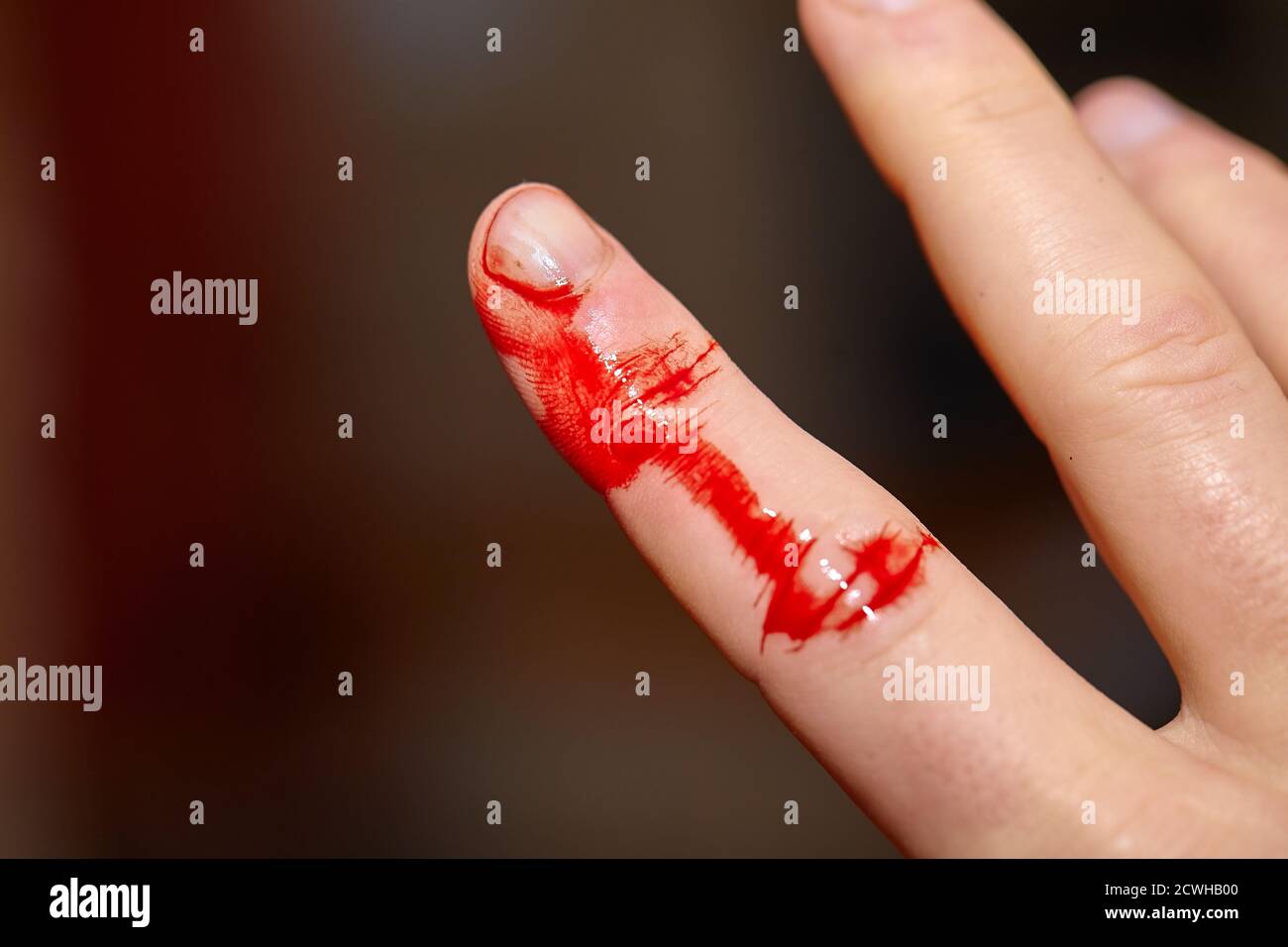 Hand cut blood bleeding hi-res stock photography and images - Alamy