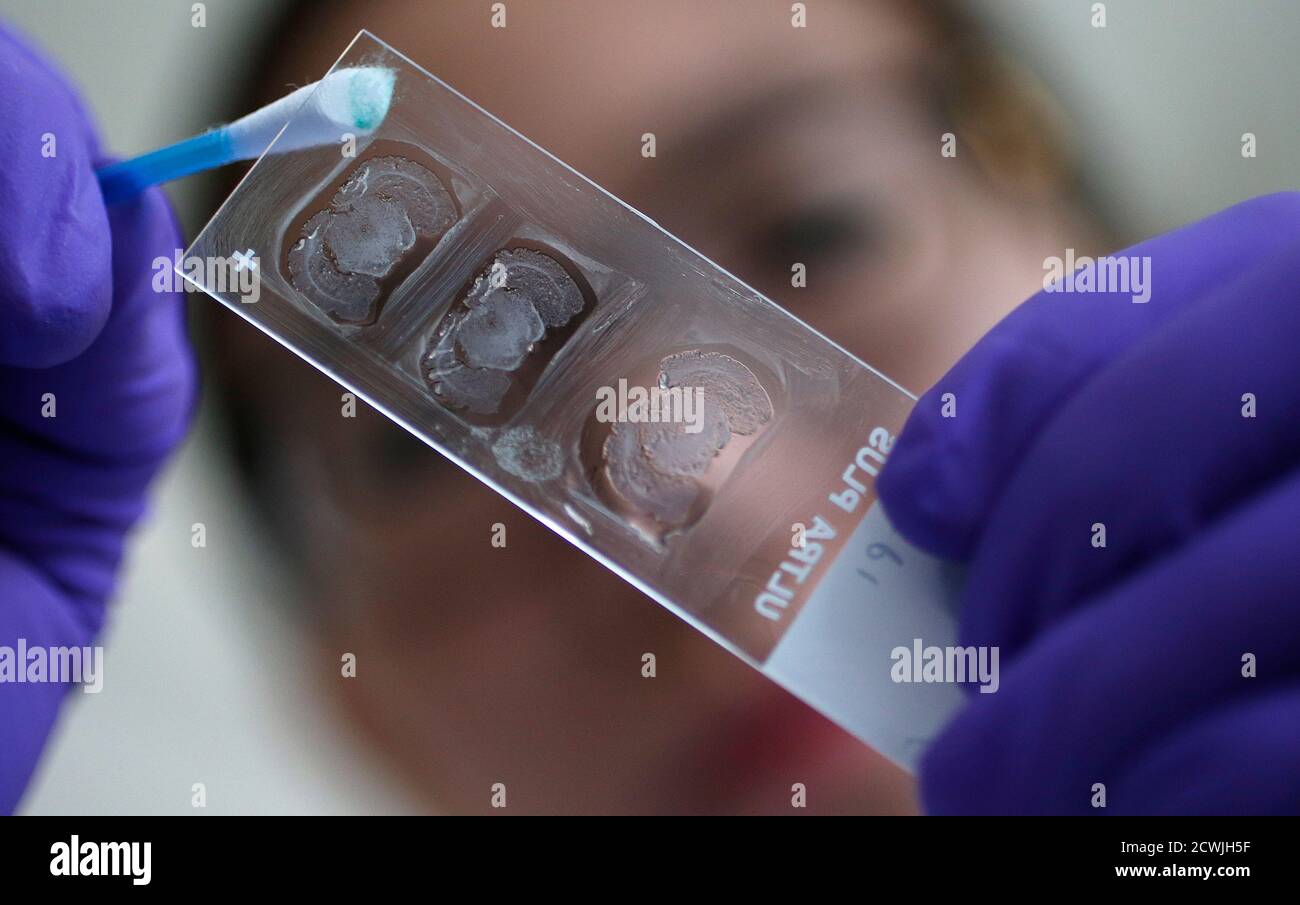 Graduate Student Yein Nam Stains Rodent Parkinsonian Brain Sections In The Nanomedicine Lab At Ucl S School Of Pharmacy In London May 2 2013 Is Nanomedicine The Next Big Thing A Growing Number