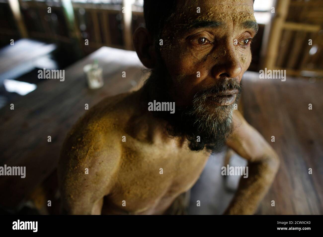 Jaynal 60 Takes A Break As He Works In A Small Bidi Cigarette Factory At Haragach In Rangpur District Bangladesh July 13 13 According To A 12 Study By Us Based Ngo Campaign