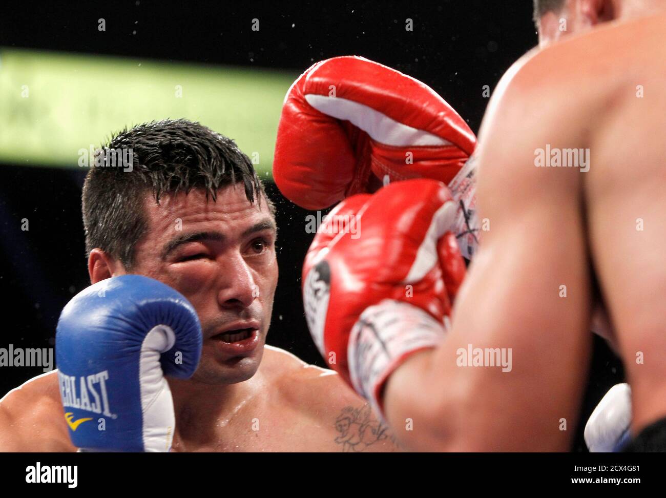 How Do Boxers Reduce Eye Swelling