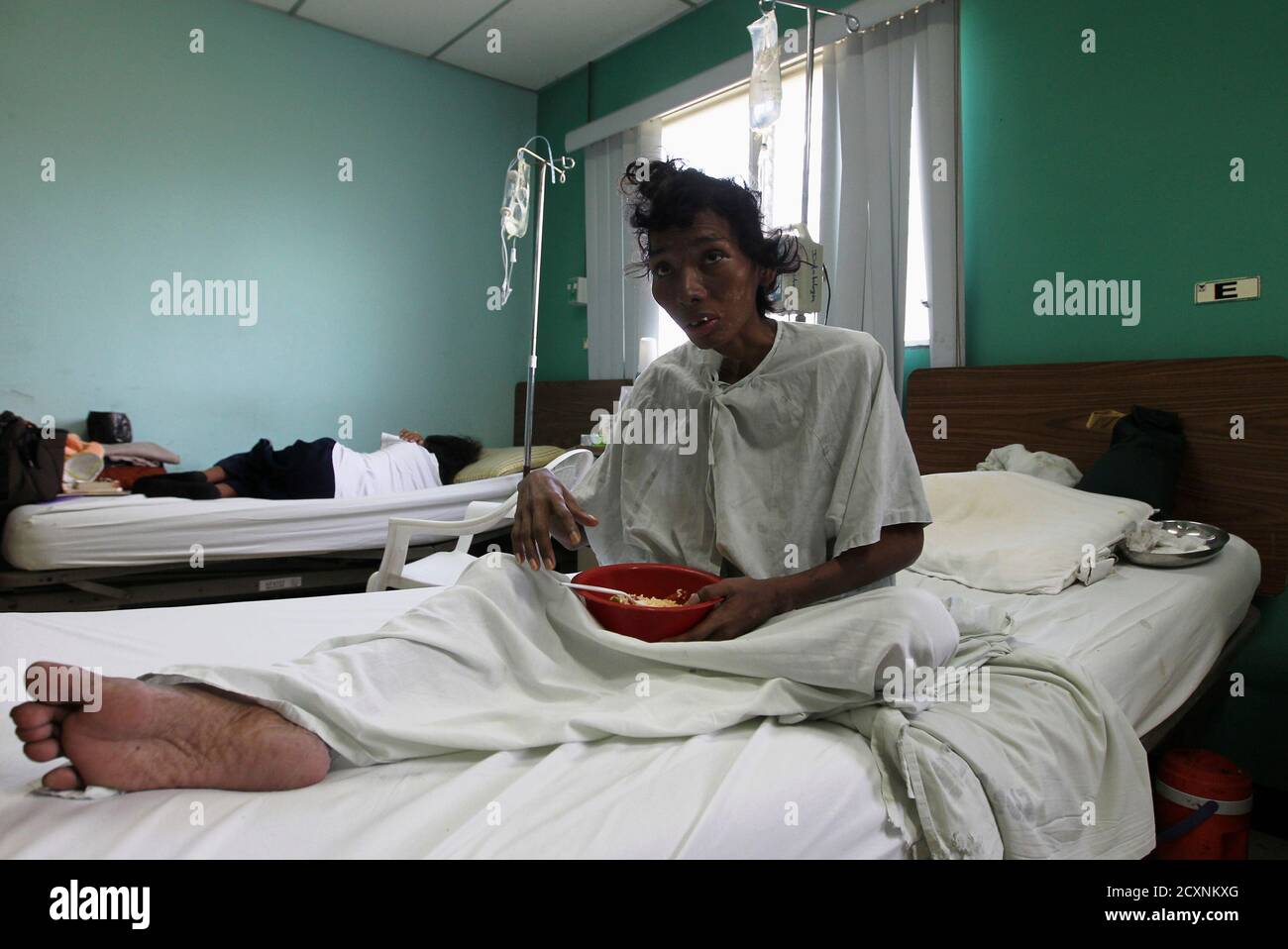 Aids patient hospital bed hires stock photography and images Alamy