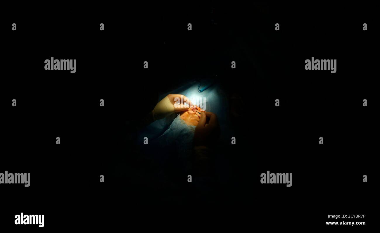 Doctors Perform A Facial Deformity Repair Surgery Provided By Operation Smile For A Patient At The Vietnam Cuba Hospital In Hanoi November 18 2014 As Many As 300 Multinational Medical Volunteers From Operation smile is a nonprofit medical service organization based in virginia beach, virginia, founded in 1982.