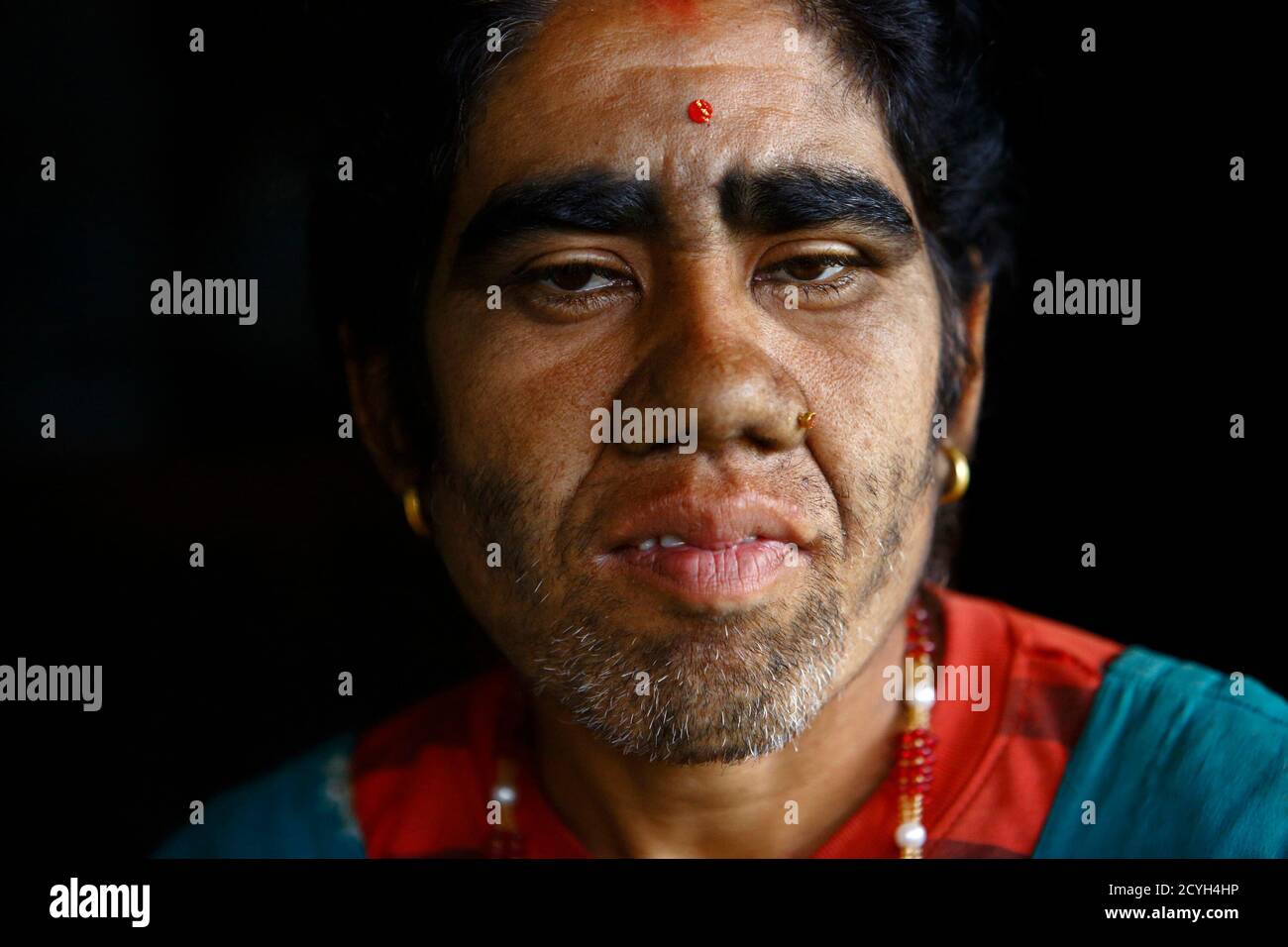 Hair growth before hires stock photography and images Alamy