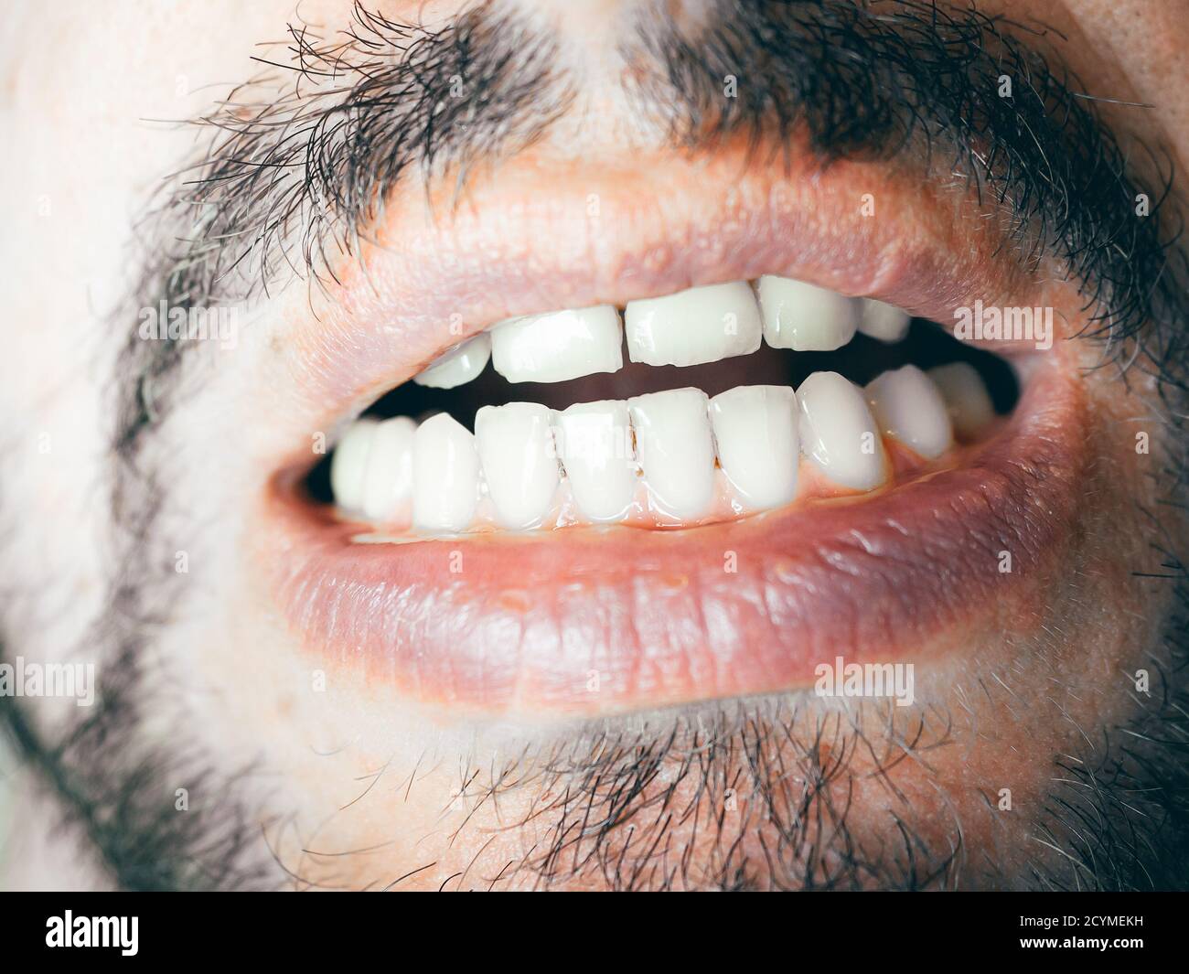 teeth bristles