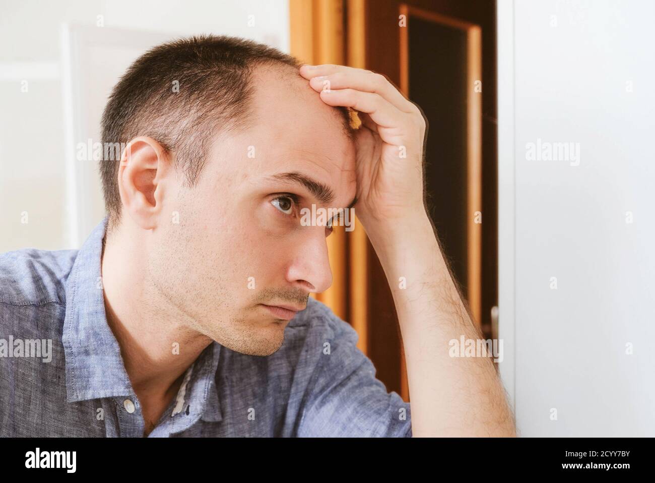 Balding young when what to do 