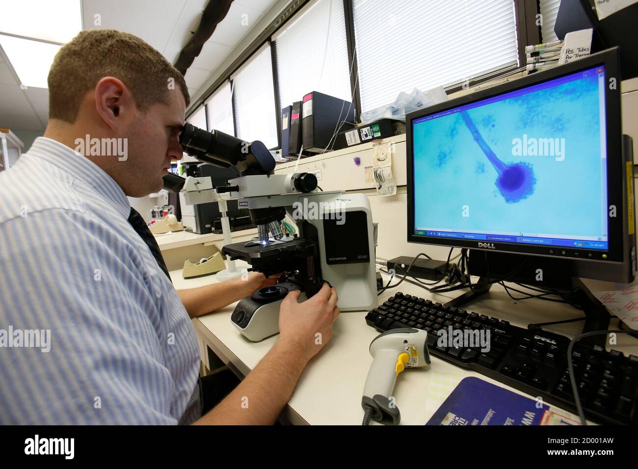 Aspergillus fumigatus fungus hi-res stock photography and images - Alamy