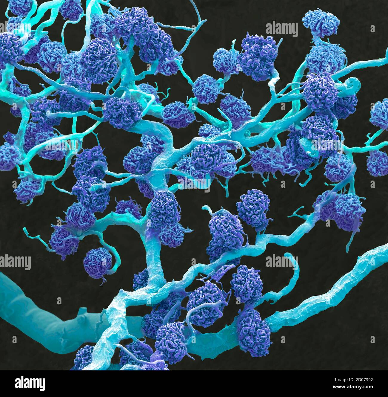 Kidney glomeruli. Coloured scanning electron micrograph (SEM) of a resin cast of glomeruli capillaries and the larger blood vessels supplying them wit Stock Photo