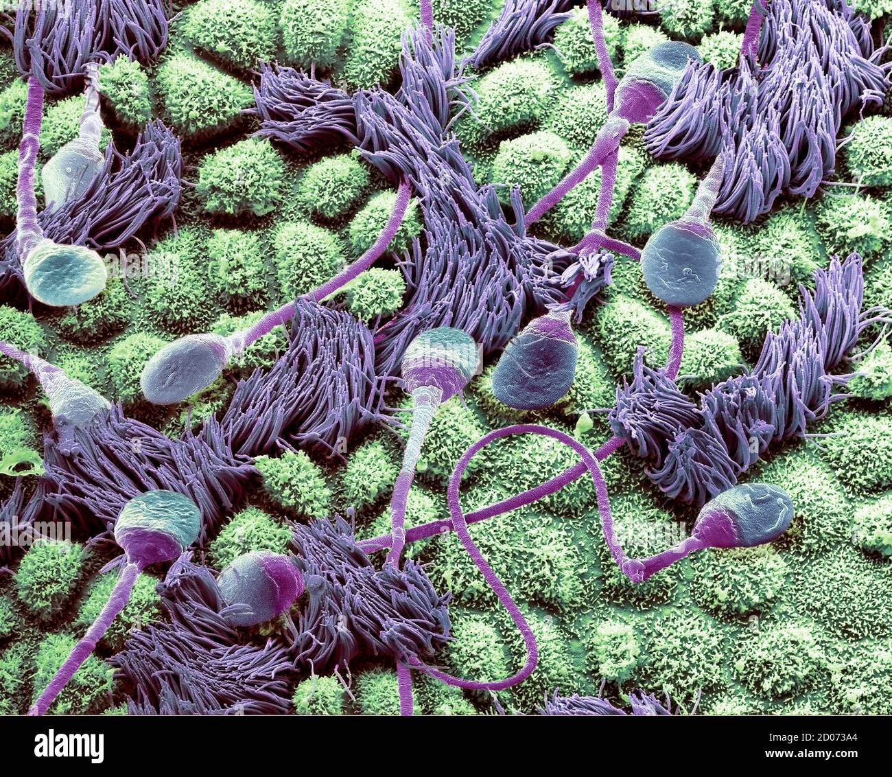 Sperm in a fallopian tube. Coloured composition scanning electron micrograph (SEM) of human sperm travelling through a fallopian tube (oviduct) of a f Stock Photo