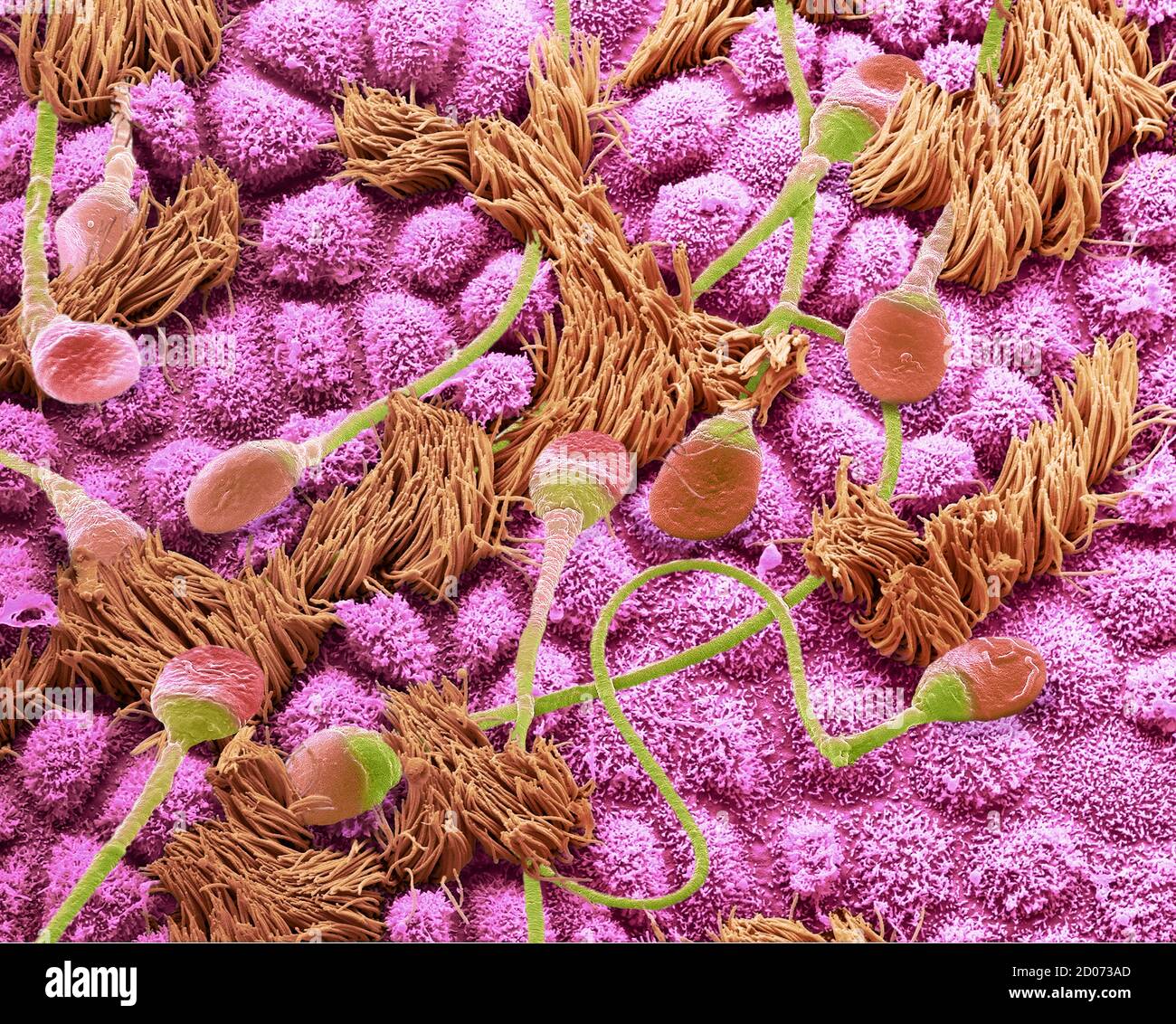 Sperm in a fallopian tube. Coloured composition scanning electron micrograph (SEM) of human sperm travelling through a fallopian tube (oviduct) of a f Stock Photo