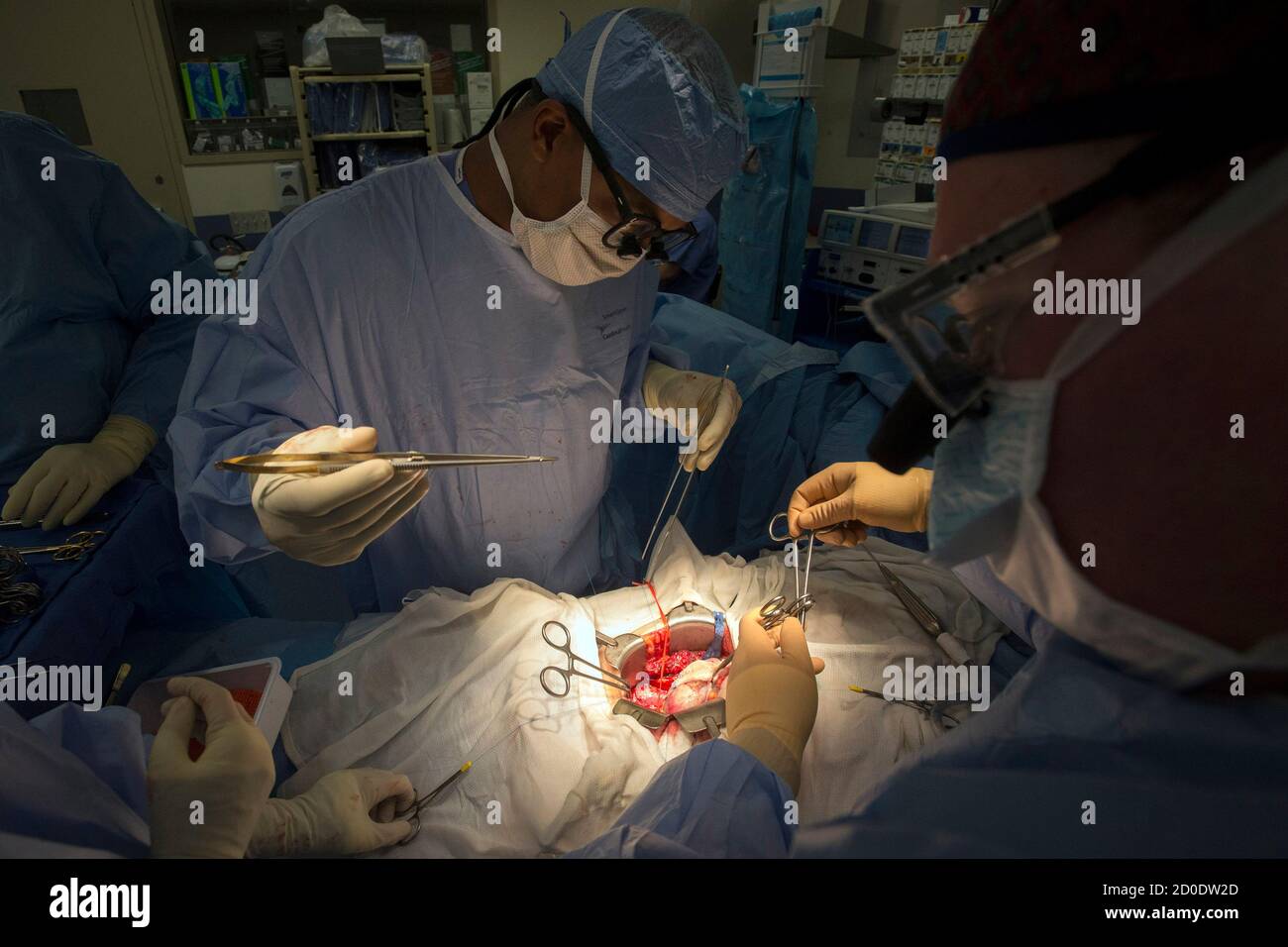 Transplanted organ hires stock photography and images Alamy
