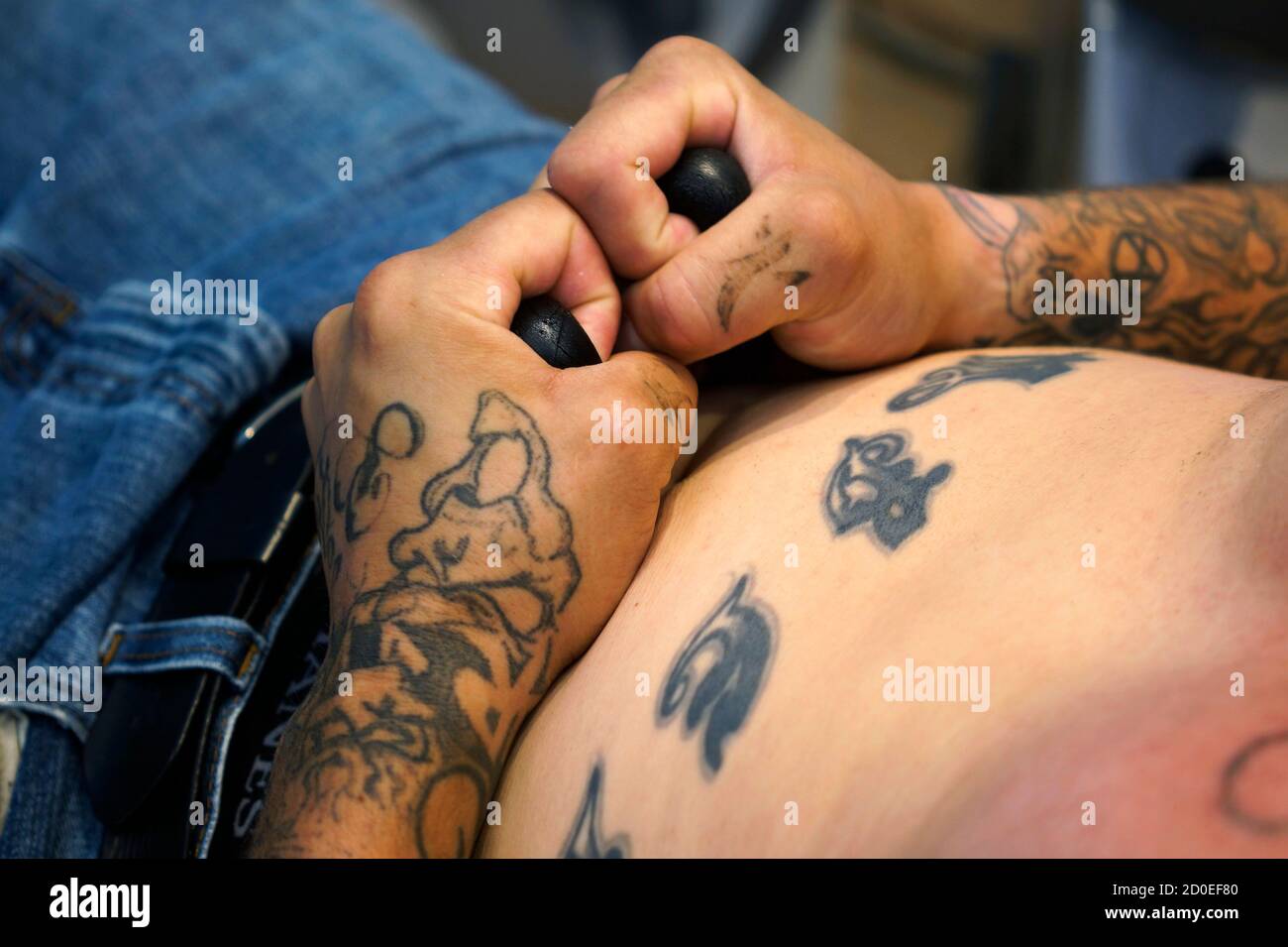 COLORADO SPRINGS TATTOO REMOVAL  Tattoo Removal Colorado Springs