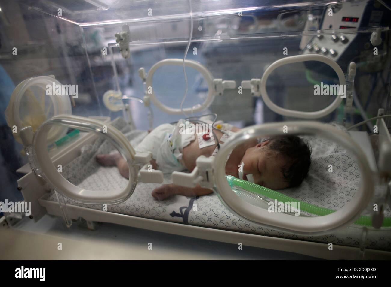 Palestinian baby girl Shayma Shiekh al-Eid lies in an incubator after doctors delivered her from the womb of her mother, whom medics said was killed in an Israeli air strike, at a hospital in Khan Younis in the southern Gaza Strip July 27, 2014. REUTERS/Ibraheem Abu Mustafa (GAZA - Tags: POLITICS CIVIL UNREST HEALTH TPX IMAGES OF THE DAY) Stock Photo