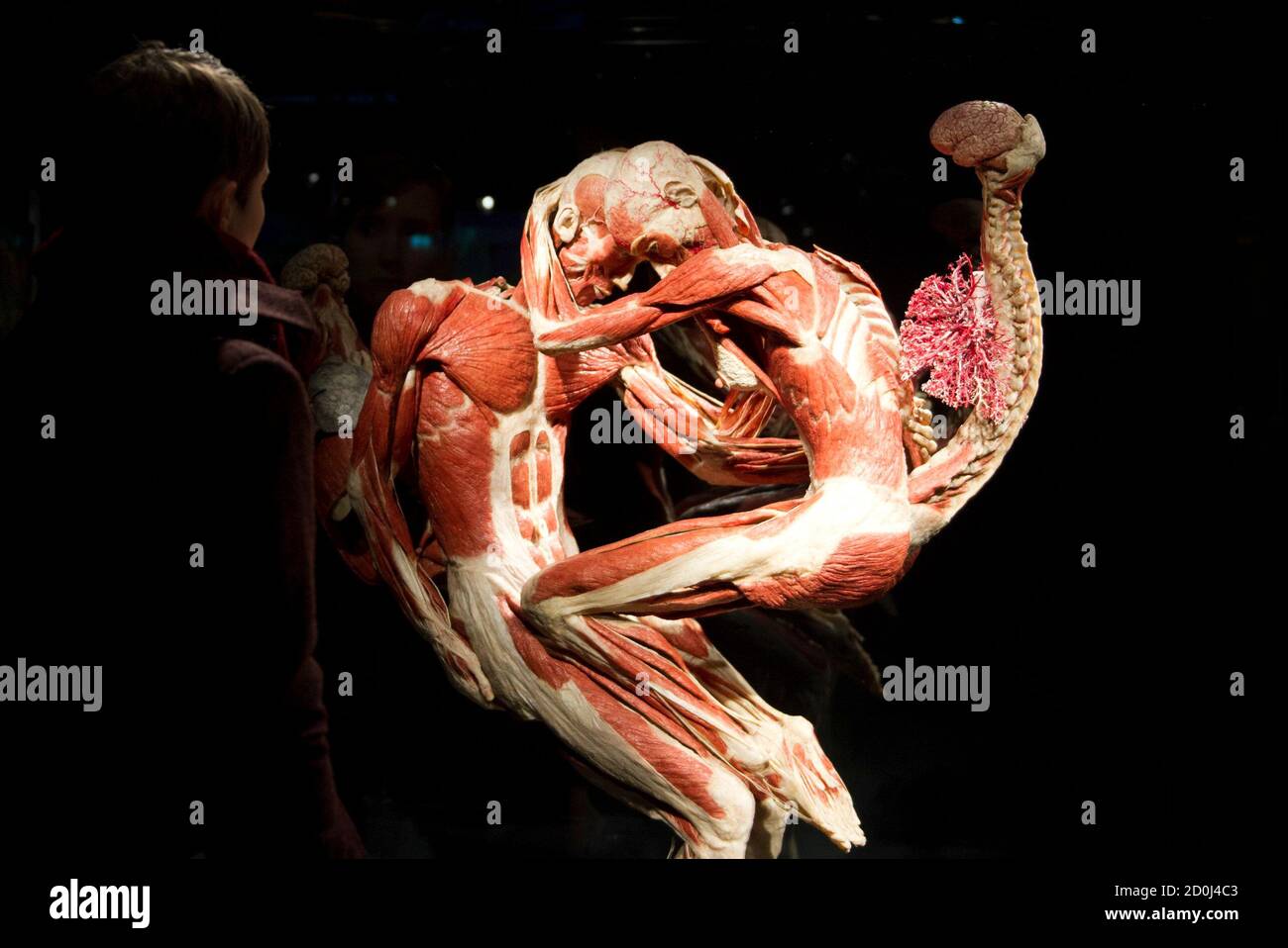 A visitor looks at plastinated human bodies during a press ...
