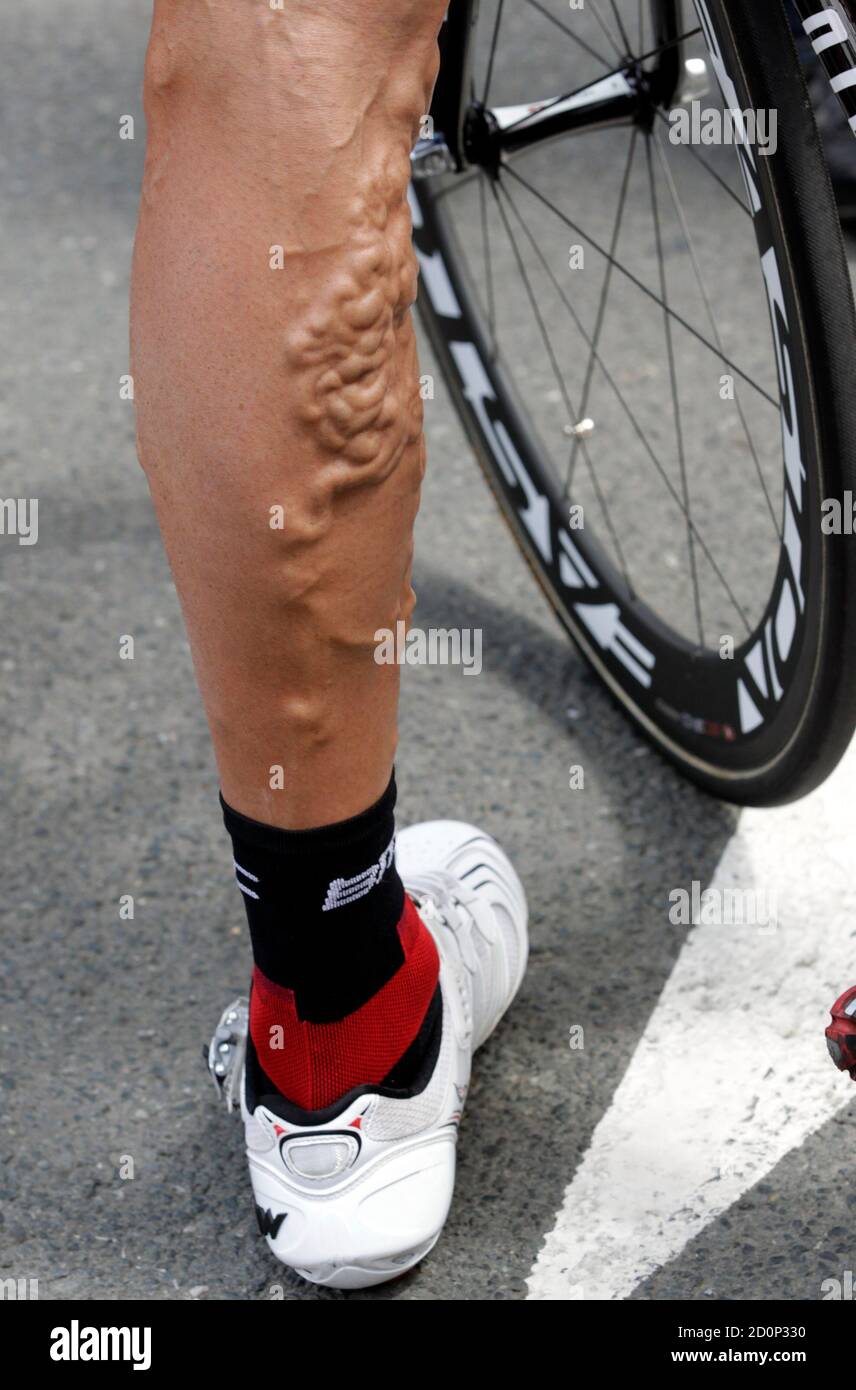 A leg of a rider is seen at the start of the fifth stage of the Tour de  France 2011 cycling race from Carhaix to Cap Frehel July 6, 2011.  REUTERS/Denis Balibouse (