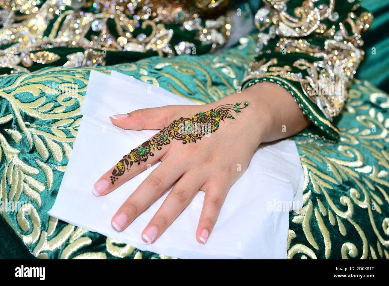 Black henna: 'My holiday henna tattoo scarred me for life' - BBC Three
