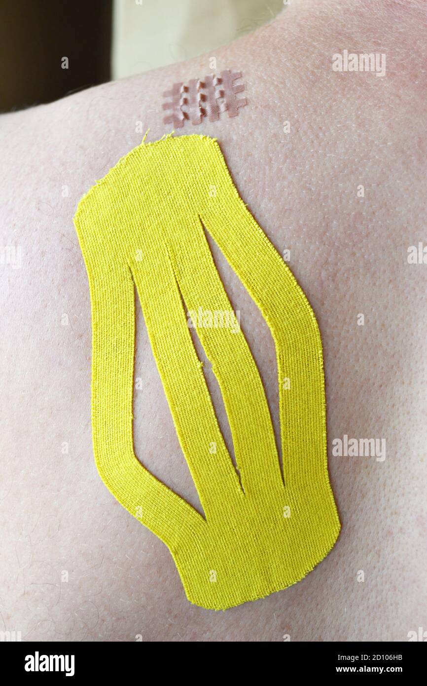 Big yellow medical taping and little cross medical taping on the Caucasian man's shoulder blade, selective focus Stock Photo