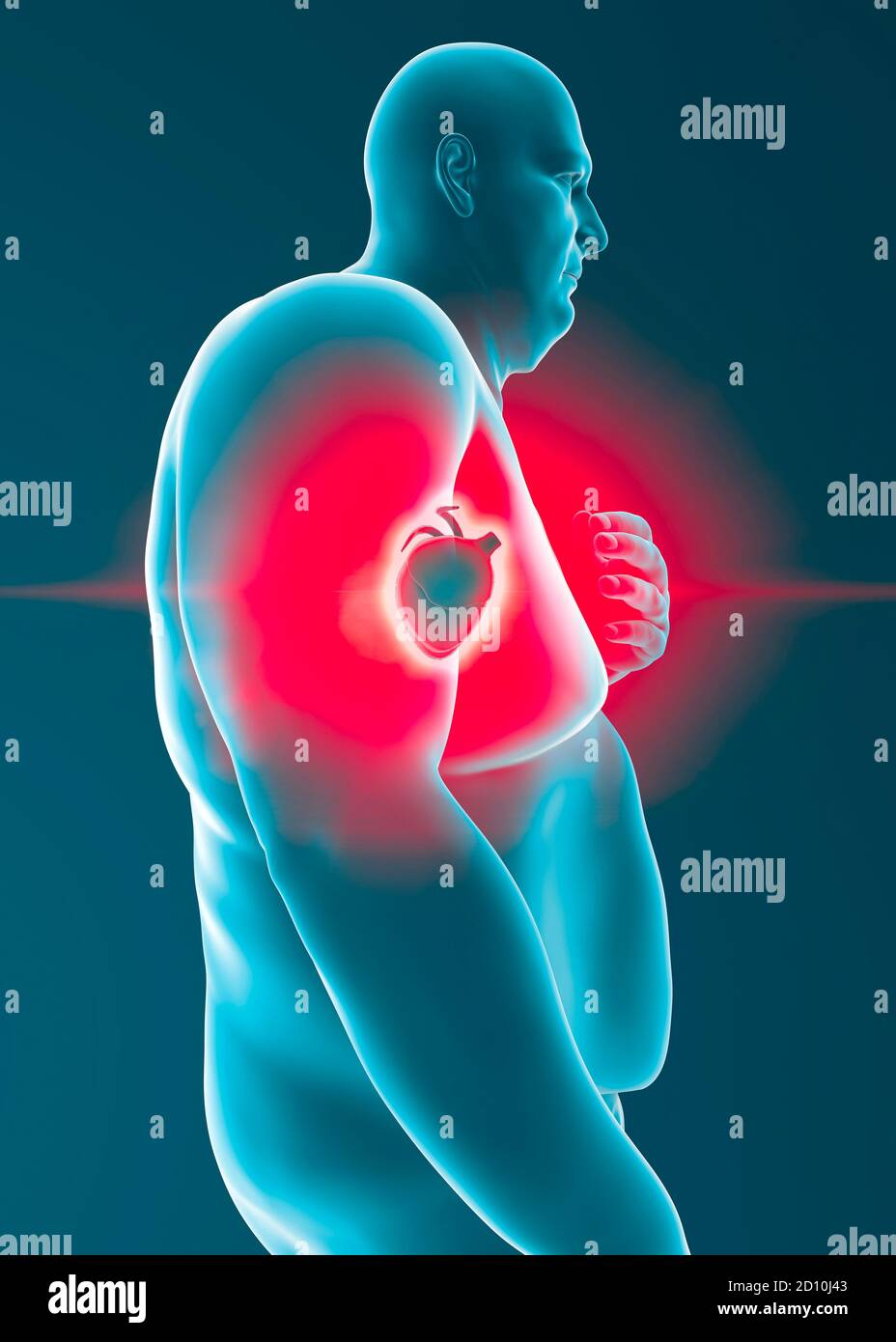 Overweight disease hires stock photography and images Alamy