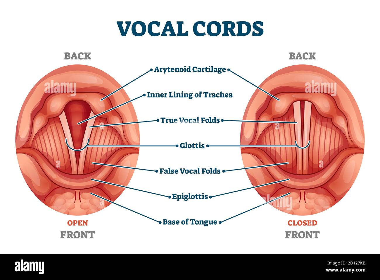 True vocal cords hi-res stock photography and images - Alamy