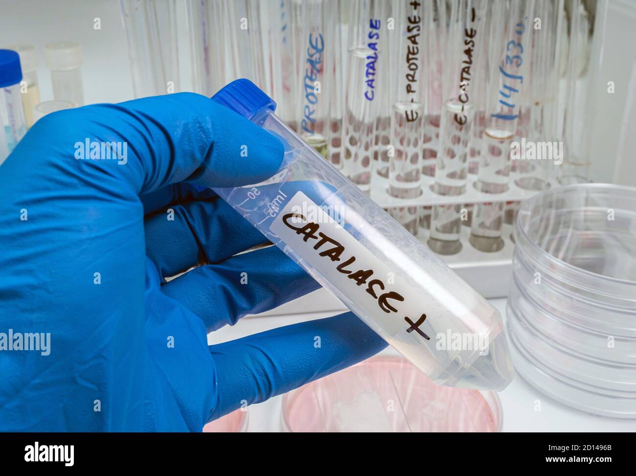 Scientist holds  vial with catalase enzyme that helps regulate  cytokine production, protects oxidative injury and suppresses SARS-CoV-2 replication, Stock Photo