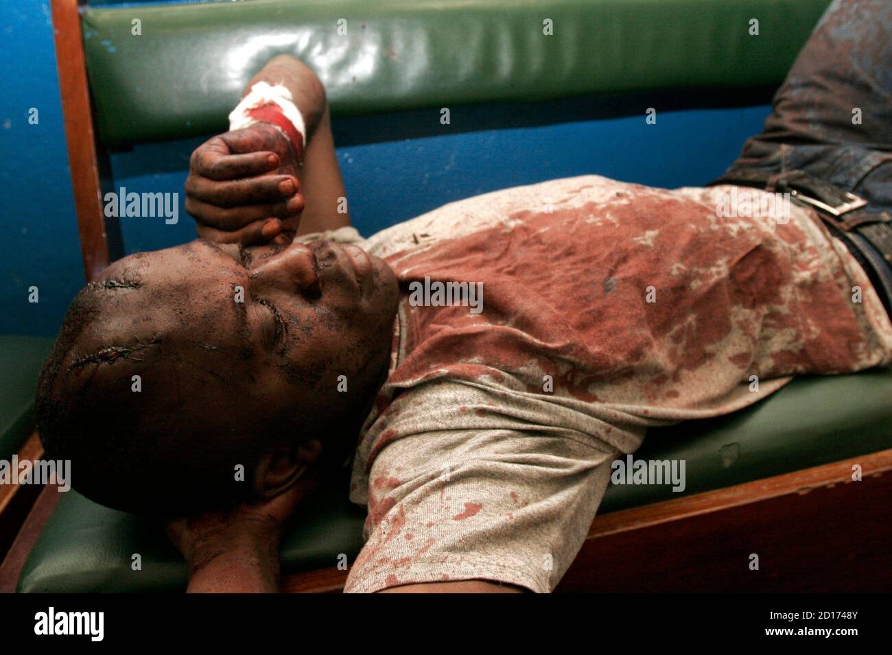 A man wounded during ethnic violence waits for assistance in Nairobi January 2, 2008. President Mwai Kibaki's government accused rival Raila Odinga's party of unleashing 'genocide' in Kenya on Wednesday as the death toll from tribal violence over a disputed election passed 300. REUTERS/Thomas Mukoya   (KENYA) Stock Photo