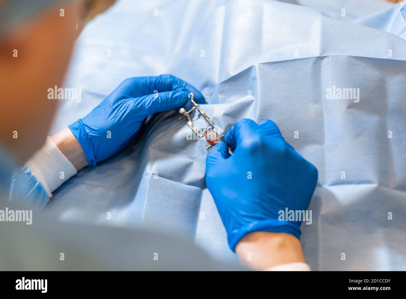 A professional ophthalmologist performs eye surgery with a microscope