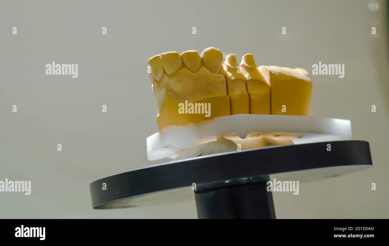 Automatic 3D dental scanner for dental gypsum model scanning and measuring with rotating platform - close up view. Stomatology, medicine, restoration Stock Photo