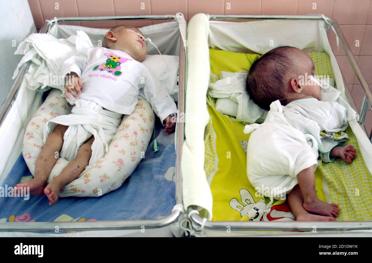 Agent Orange Vietnam Children High Resolution Stock Photography And Images Alamy Agent Orange Vietnam Children High Resolution Stock Photography And Images Alamy