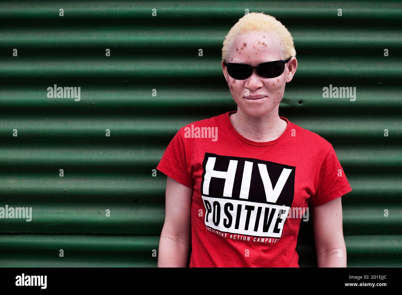 Khanyie Mzamane, 24, who has albinism and is HIV-negative, poses for a  portrait while wearing a T-shirt in support of her sister, who is HIV-positive,  in Cape Town's Khayelitsha township February 15,