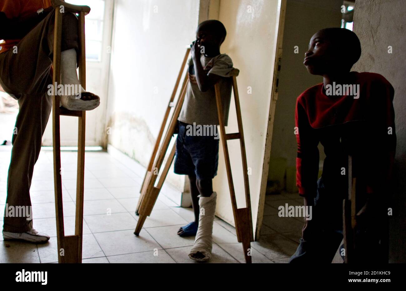 Polio leg hires stock photography and images Alamy