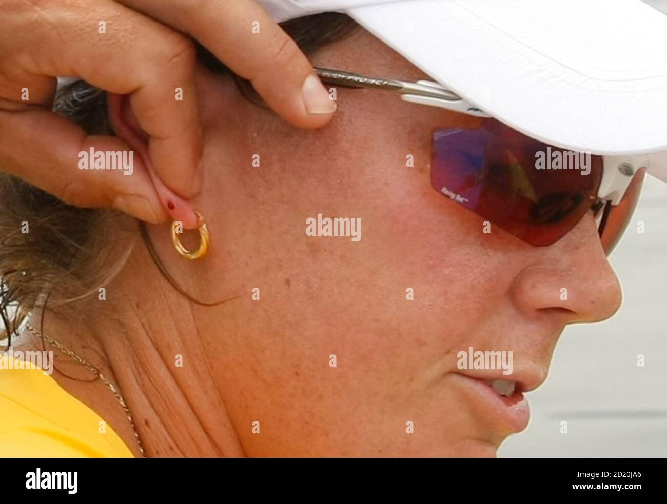 Blood is squeezed from the ear of Australia's Lisa Oldenhof for a lactate reading during a training session for the K-4 500 metres canoeing event ahead of the Beijing 2008 Olympic Games August 5, 2008.     REUTERS/Tim Wimborne (CHINA) Stock Photo