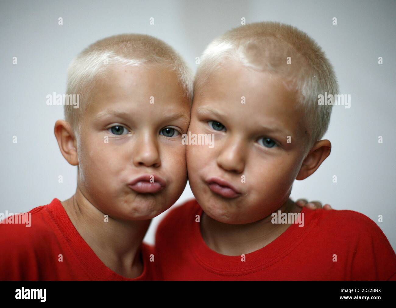 Non Identical Twins High Resolution Stock Photography And Images Alamy Non Identical Twins High Resolution Stock Photography And Images Alamy