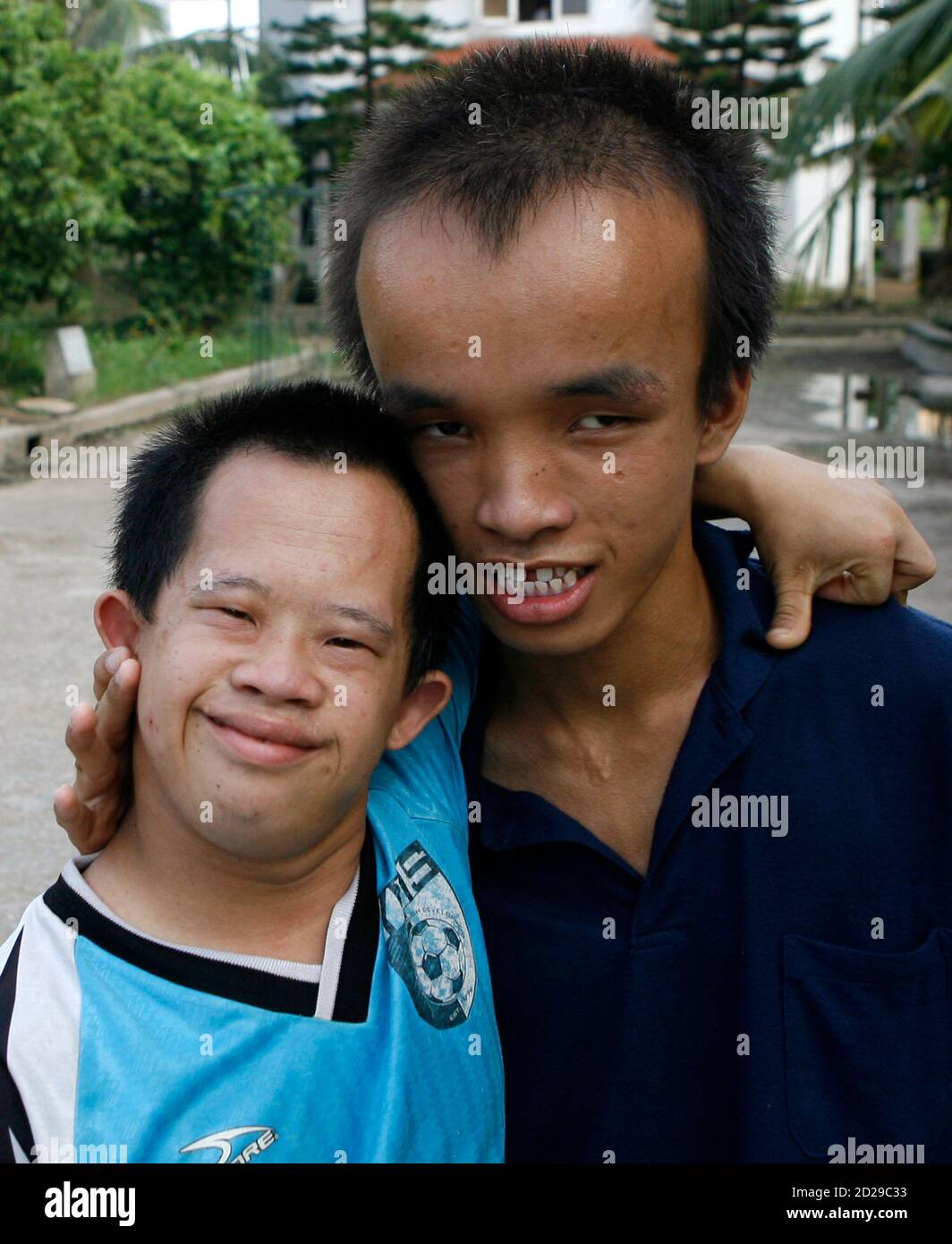 Agent Orange Victims Pose At The Friendship Village A Hospice For Victims In Hanoi August 10 09 Vietnam Launched An Orange Day Campaign On Monday To Raise Funds For People It Says Agent Orange Victims Pose At The Friendship Village A Hospice For Victims In Hanoi August 10 09 Vietnam Launched An Orange Day Campaign On Monday To Raise Funds For People It Says