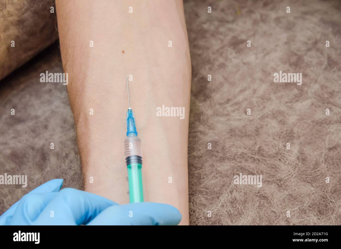 female doctor conducts a Mantoux test for a man in a clinic. Hand and syringe close-up Stock Photo