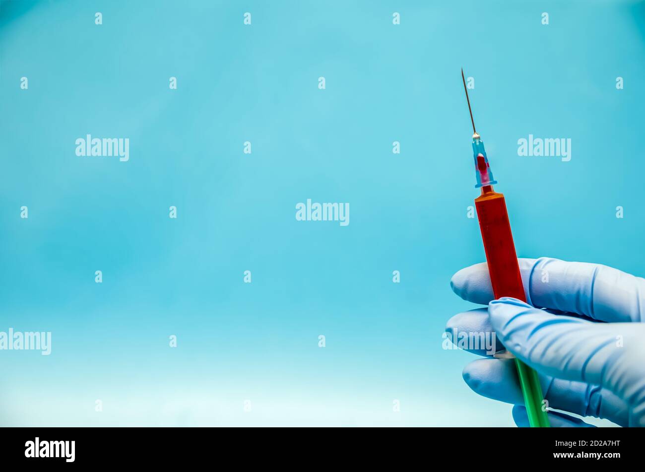 hand in blue gloves holds a syringe with blood or vaccine on a blue ...