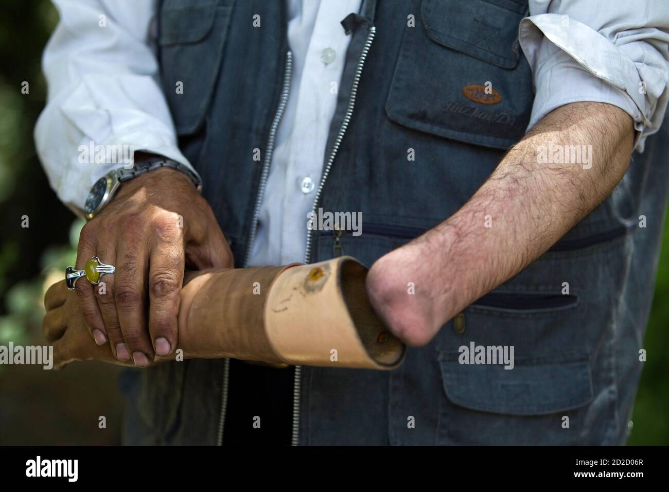 Page 6 - Prosthetic Hand Not Teeth Not Leg High Resolution Stock  Photography and Images - Alamy