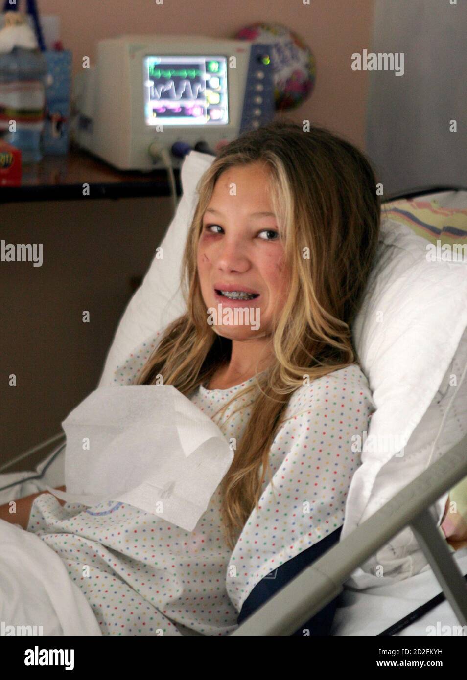 Francesca Lewis 12 Is Seen In Hospital In David City In The Chiriqui Province 270 Miles 435 Km West Of Panama City December 28 07 Rescue Crews In Panama Found Lewis An