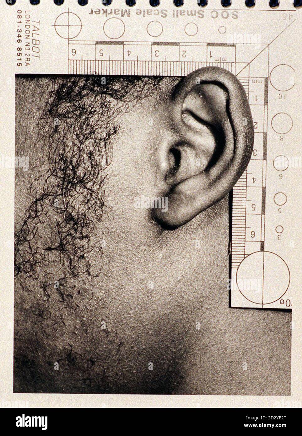 Police issued photo of convicted burglar Calvin Sewell's left ear. The over-careful Sewell, always listened carefully to make sure no one was around before breaking in but pressing his vital organ against doors and windows in 13 different places proved to be a fatal mistake. Sewell made legal history when sentenced to a years jail at Southwark Crown Court today (Friday) becoming the first criminal in Britain to have a mould taken of his ear by police. See PA Story COURTS Ears. Copy by Ben Curtis/PA. Stock Photo
