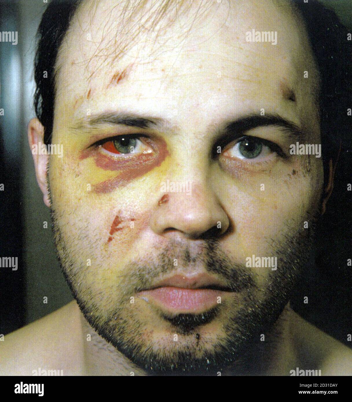 Picture dated 13/09/94 of Andrew Russell.  Two former IRA prisoners  sued the Home Office for damages over injuries they claim were inflicted on them by prison officers after an unsuccessful breakout from prison.   * Danny McNamee, 40, and Liam McCotter, 37, were at the High Court in London to hear their counsel, Tim Owen QC, allege that they were subjected to 'excessive force' at the time of their escape bid in September 1994 from Whitemoor prison in Cambridgeshire.  The Home Office denies liability and argues that all the injuries resulted from their actions in escaping or from the applicati Stock Photo