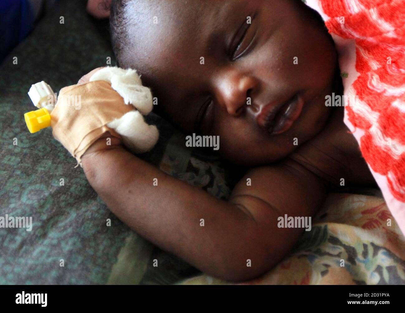 A child who is an internally displaced person (IDP), receives treatment at the Akobo hospital during a visit by Norway's Foreign Minister Jonas Gahr Stoere in Akobo, June 2, 2010. REUTERS/Mohamed Nureldin Abdallah (SUDAN - Tags: CIVIL UNREST HEALTH SOCIETY POLITICS) Stock Photo
